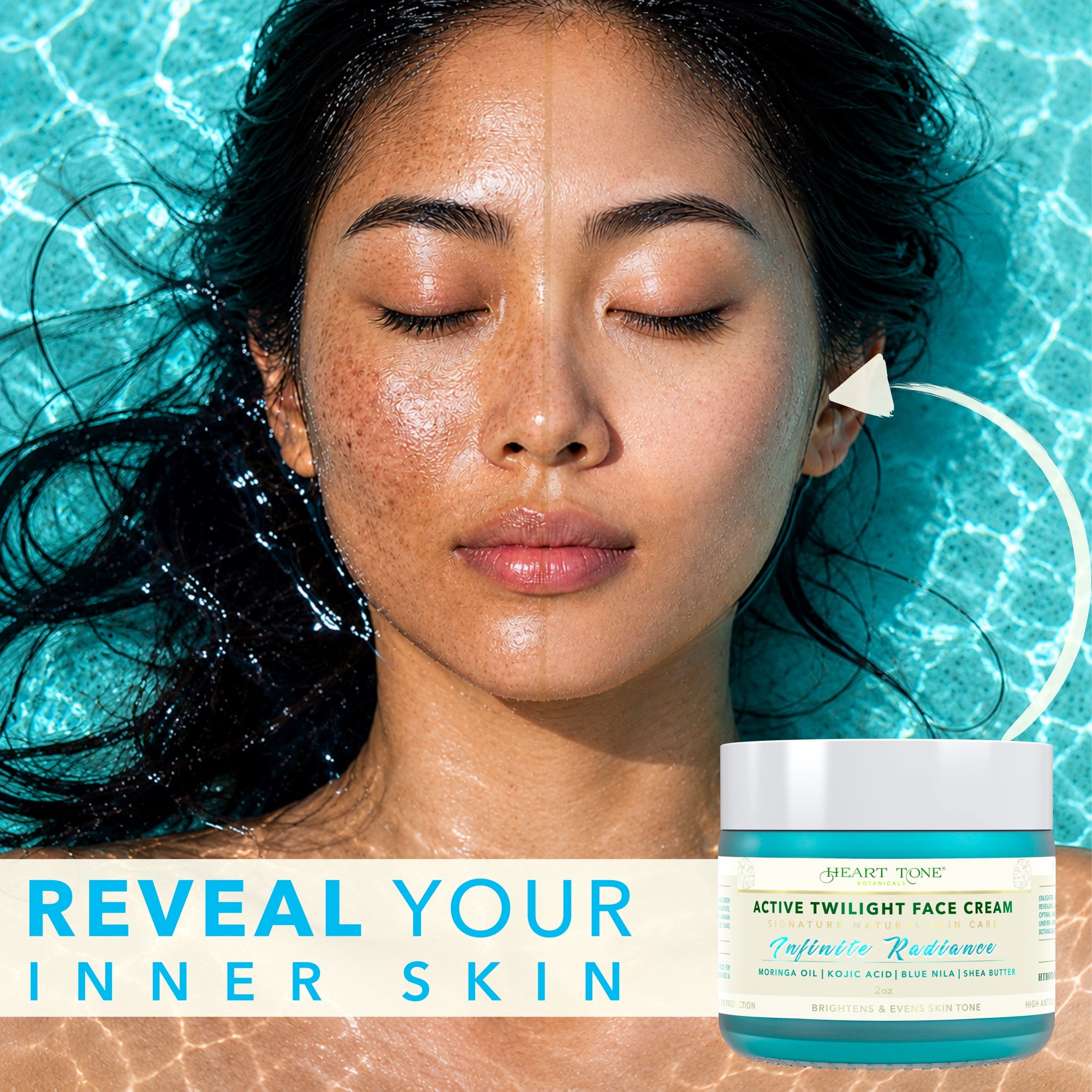 Get to the Bottom — Fade Dark Spots, Melasma, Hyperpigmentation & Acne Marks